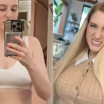 Meghan Trainor breast augmentation